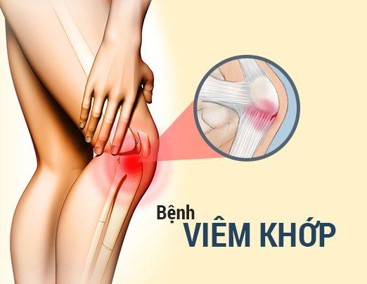 Review bổ khớp Move Free 200 viên.