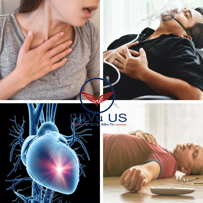 Tác dụng thuốc Cholestoff Plus.