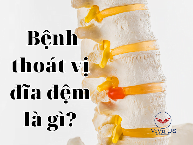 benh thoat vi dia dem la gi